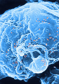 Hiv-1-deeltjes (oranje) op lymfocyt, in kweek. 