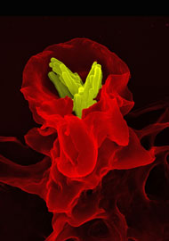 Een fagocyt omvat een Mycobacterium tuberculosis (groen).
