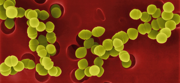De VRE-bacterie is ongevoelig voor de gangbare antibiotica. Beeld: Corbis