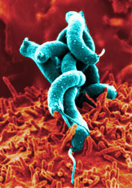 Helicobacter pylori op magepitheel. 