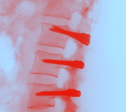 ‘Wervelkolompatiënten hebben een ander klaagpatroon dan mensen met een kapotte meniscus of een gebroken been.’ beeld: London spine clinic