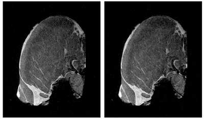De afbeelding links is een gewone MRI-scan van een karbonaadje. Tijdens het maken van de afbeelding rechts wordt bestraald. Dat beide afbeeldingen identiek zijn, laat zien dat het mogelijk is om gelijktijdig een MRI-scan te maken en te bestralen. (Raaymakers, c.s. Phys. Med. Biol. 2009.). Beeld: J.J.W. Lagendijk, radiologie, UMCU